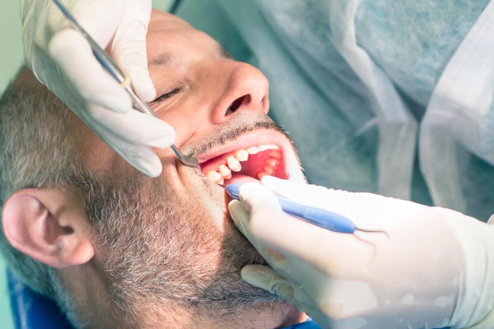 Dental care image for Start with the real question: root canals, do I need one? Dental care image for Start with the real question: root canals, do I need one?