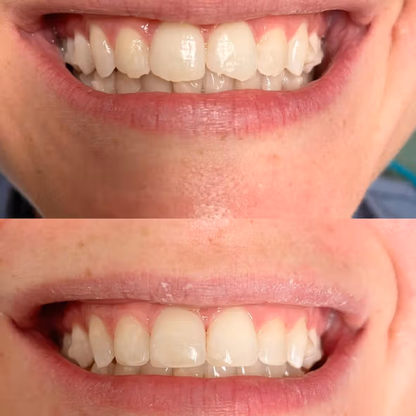 Dental care image for Smile Gallery