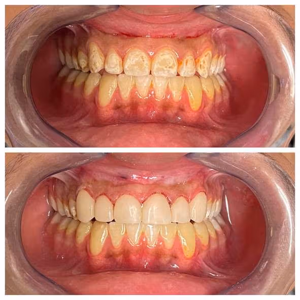 Dental care image for Smile Gallery