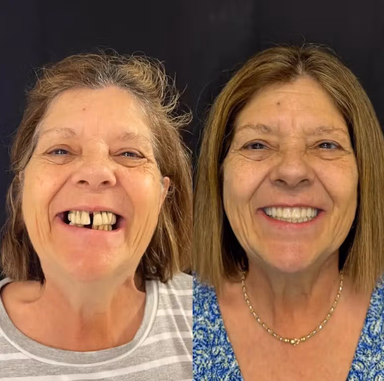 Dental care image for Smile Gallery