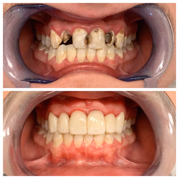 Dental care image for Smile Gallery