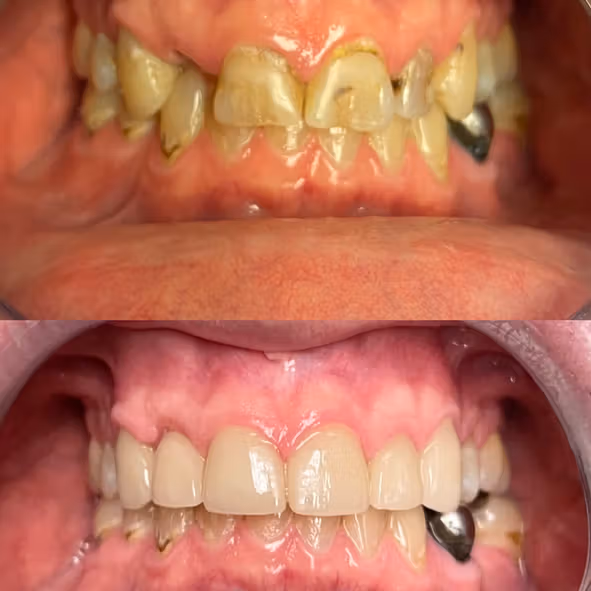 Dental care image for Smile Gallery