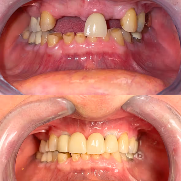 Dental care image for Smile Gallery