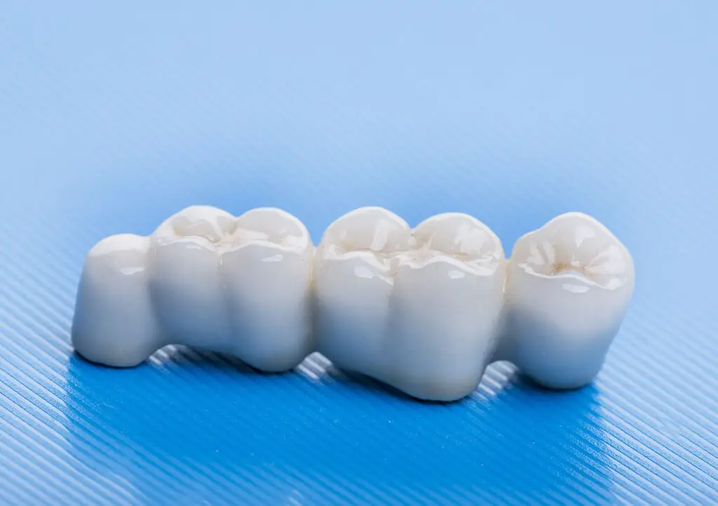 Dental care image for Dental Bridges In Summit, NJ: Restore Missing Teeth And Reclaim Your Bite Dental care image for Dental Bridges In Summit, NJ: Restore Missing Teeth And Reclaim Your Bite