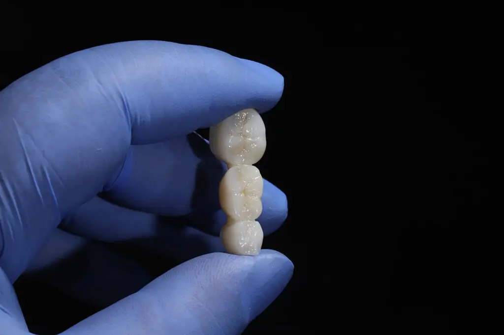 Dental care image for Dental Bridges In Summit, NJ: Restore Missing Teeth And Bring Back Comfortable Function Dental care image for Dental Bridges In Summit, NJ: Restore Missing Teeth And Bring Back Comfortable Function
