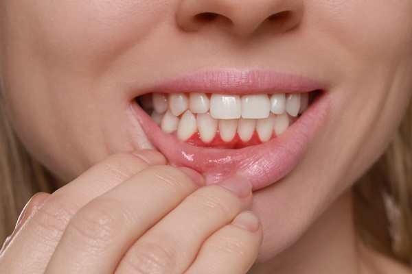 Common Signs Of Gum Disease