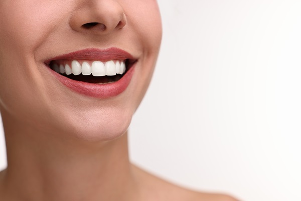 Make Your Teeth Pretty With A Smile Makeover